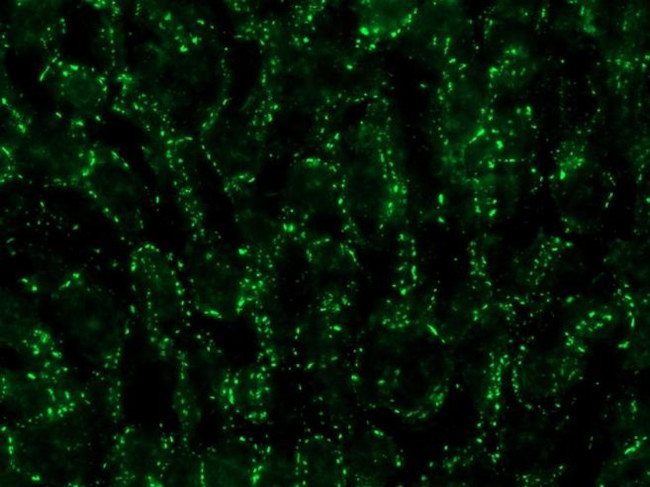 Connexin 32 Antibody in Immunohistochemistry (IHC)