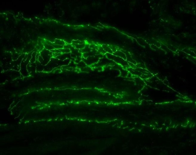 Connexin 37 Antibody in Immunohistochemistry (IHC)
