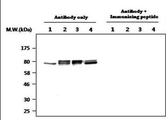 Cortactin Antibody in Western Blot (WB)