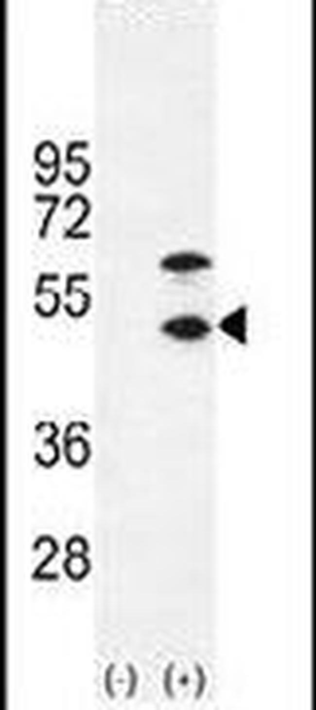 Creatine Kinase MB Antibody in Western Blot (WB)