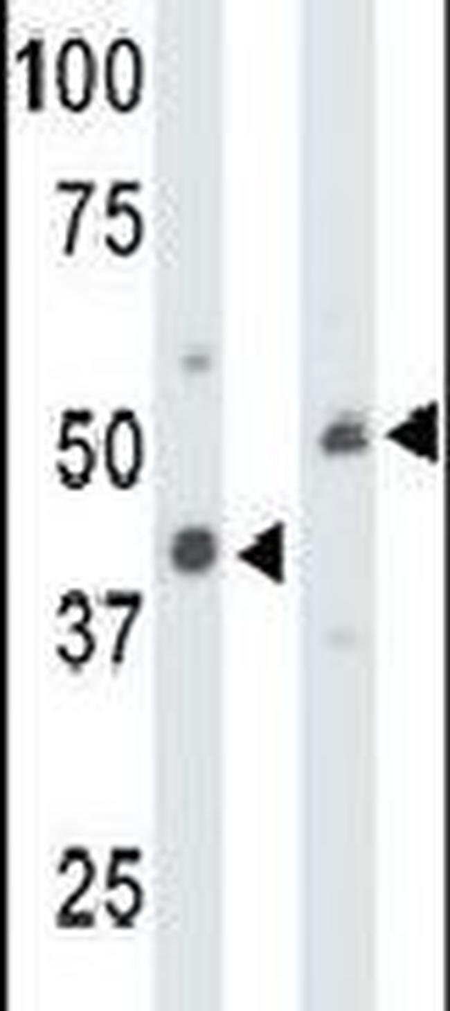 Creatine Kinase MT Antibody in Western Blot (WB)