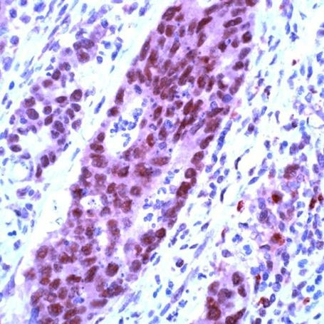 Cullin 1 Antibody in Immunohistochemistry (IHC)