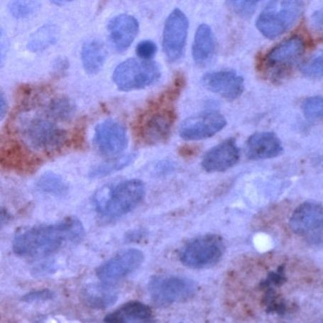 Cyclin B1 Antibody in Immunohistochemistry (IHC)