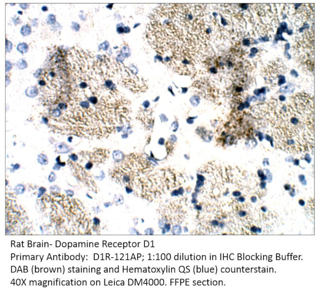 Dopamine Receptor D1 Antibody in Immunohistochemistry (IHC)