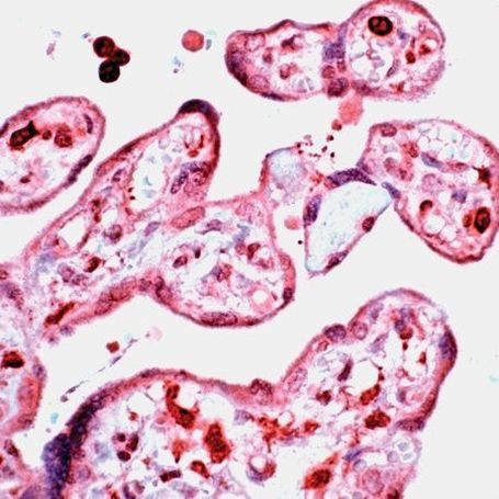 D4-GDI Antibody in Immunohistochemistry (IHC)