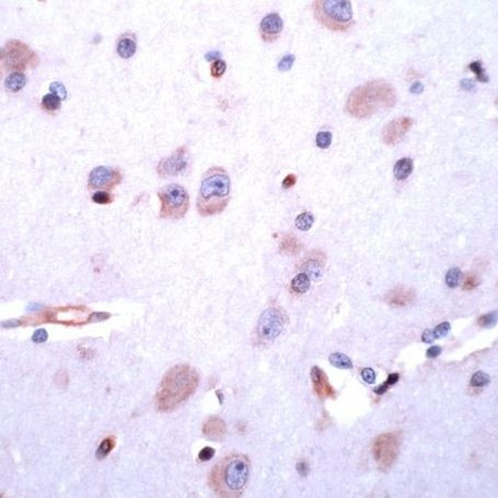 DRD5 Antibody in Immunohistochemistry (IHC)