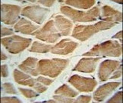 DAAM1 Antibody in Immunohistochemistry (IHC)