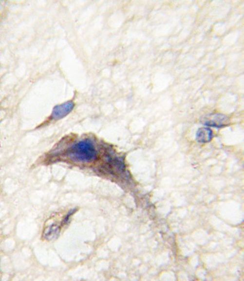 DAAM1 Antibody in Immunohistochemistry (IHC)