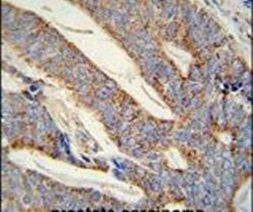 DACT1 Antibody in Immunohistochemistry (IHC)