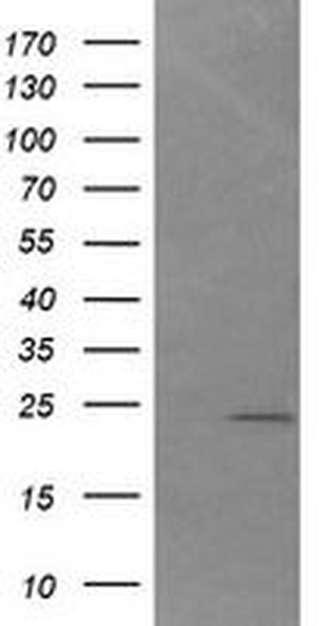 DAND5 Antibody in Western Blot (WB)