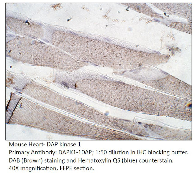 DAP Kinase 1 Antibody in Immunohistochemistry (IHC)