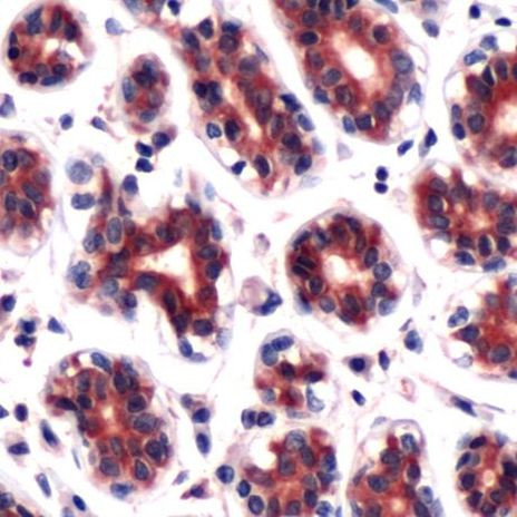 DAPK2 Antibody in Immunohistochemistry (IHC)