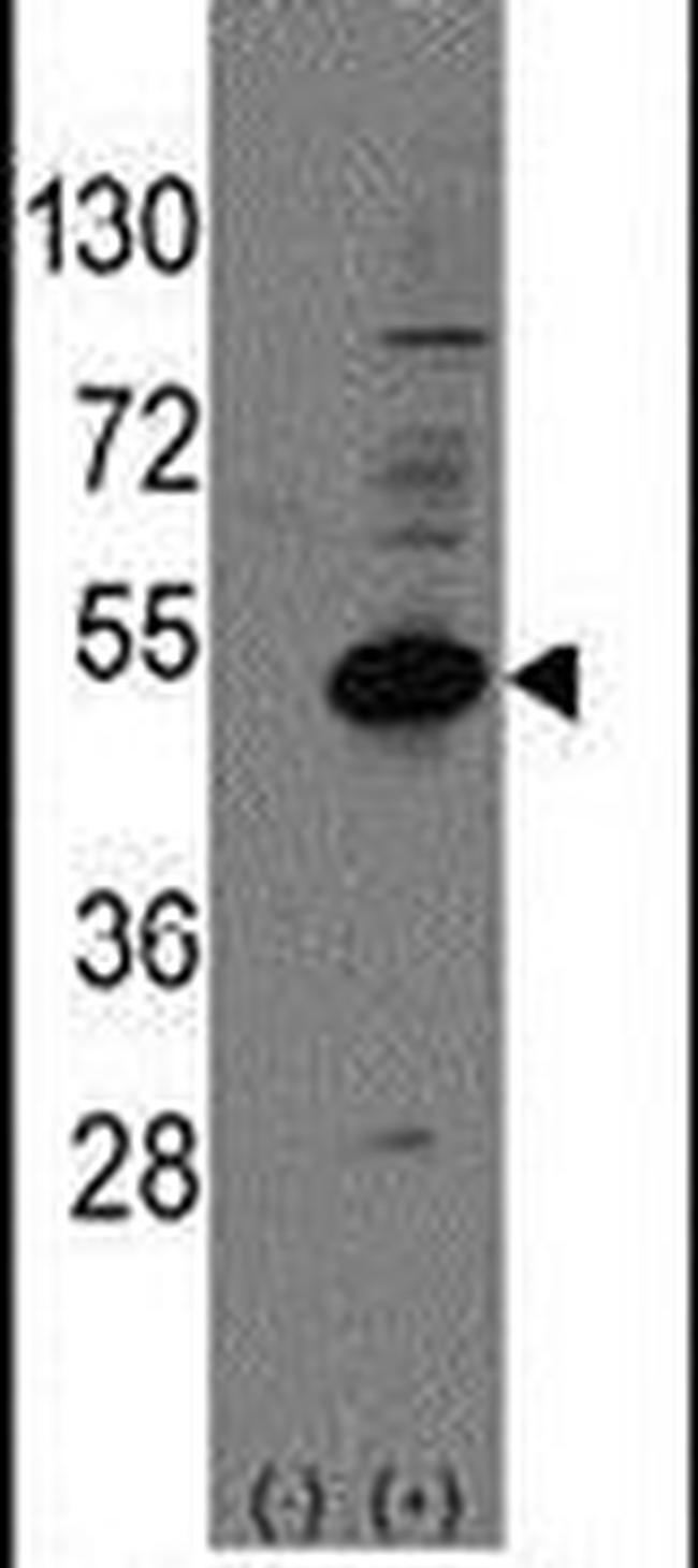 NR0B1 Antibody in Western Blot (WB)