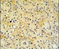 DAZAP2 Antibody in Immunohistochemistry (IHC)