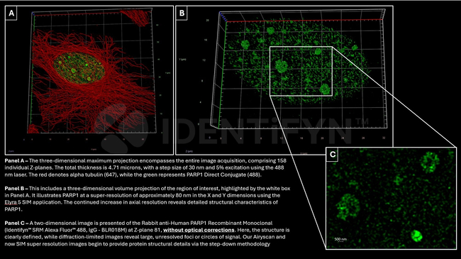 PARP1 SRM Antibody in Immunocytochemistry (ICC/IF)
