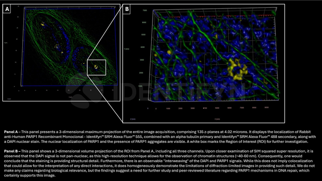 PARP1 SRM Antibody in Immunocytochemistry (ICC/IF)