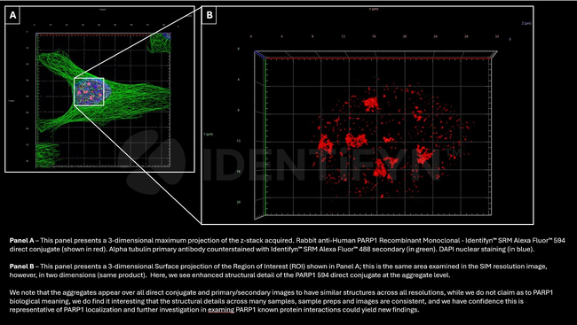 PARP1 SRM Antibody in Immunocytochemistry (ICC/IF)