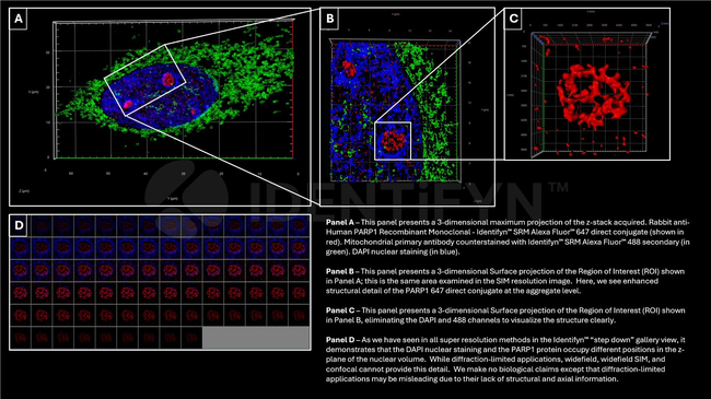 PARP1 SRM Antibody in Immunocytochemistry (ICC/IF)