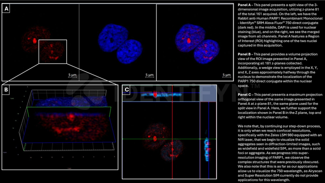 PARP1 SRM Antibody in Immunocytochemistry (ICC/IF)