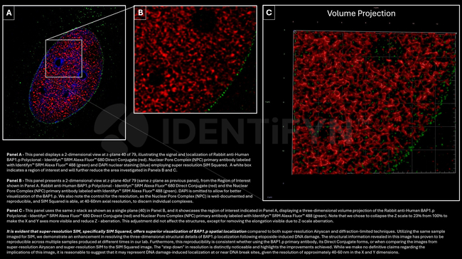 BAP1.p SRM Antibody in Immunocytochemistry (ICC/IF)