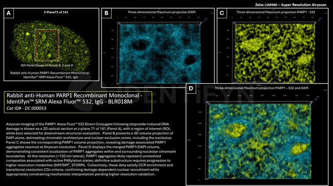 PARP1 Antibody in Immunocytochemistry (ICC/IF)