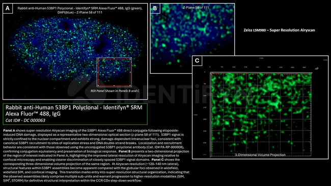 53BP1 Antibody in Immunocytochemistry (ICC/IF)