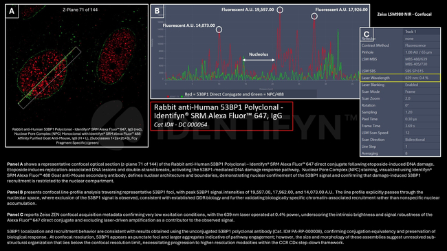 53BP1 Antibody in Immunocytochemistry (ICC/IF)