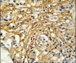 DC13 Antibody in Immunohistochemistry (IHC)