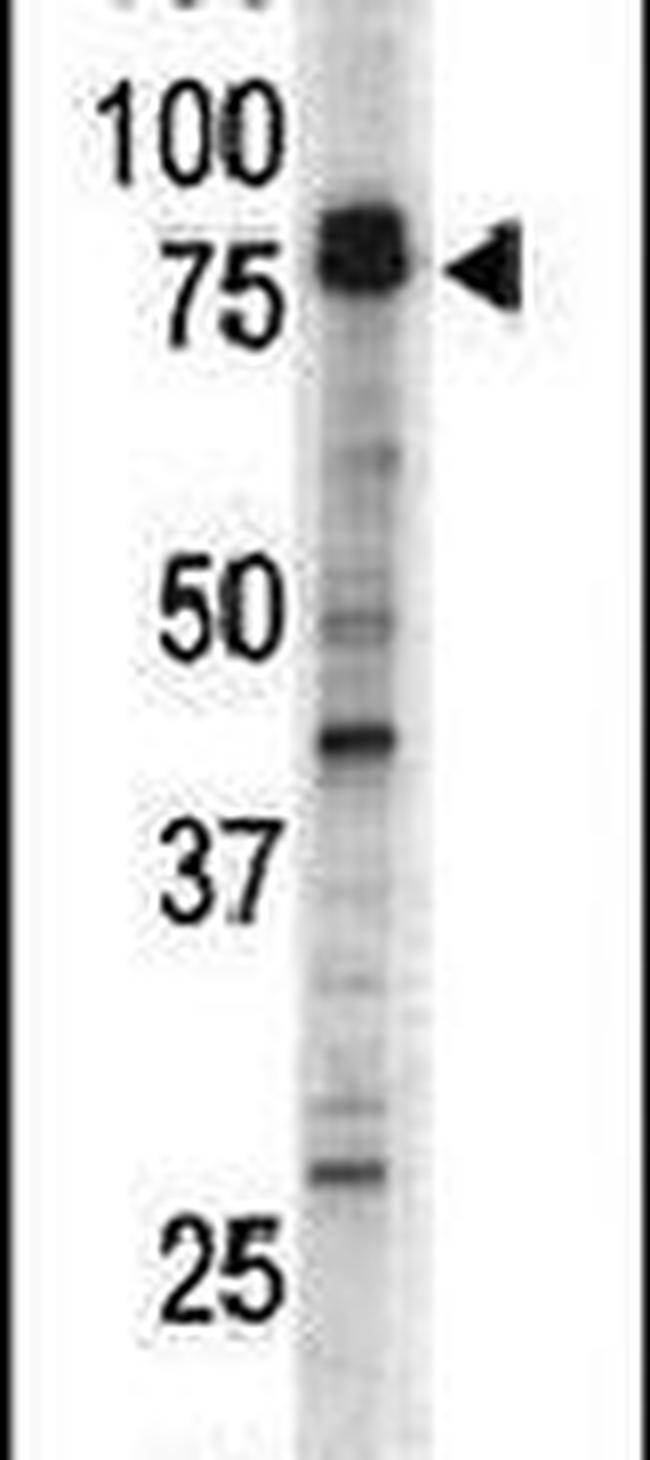DCLK1 Antibody in Western Blot (WB)