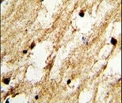 DSCC1 Antibody in Immunohistochemistry (IHC)