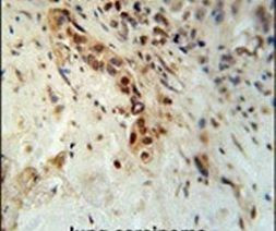 Artemis Antibody in Immunohistochemistry (IHC)