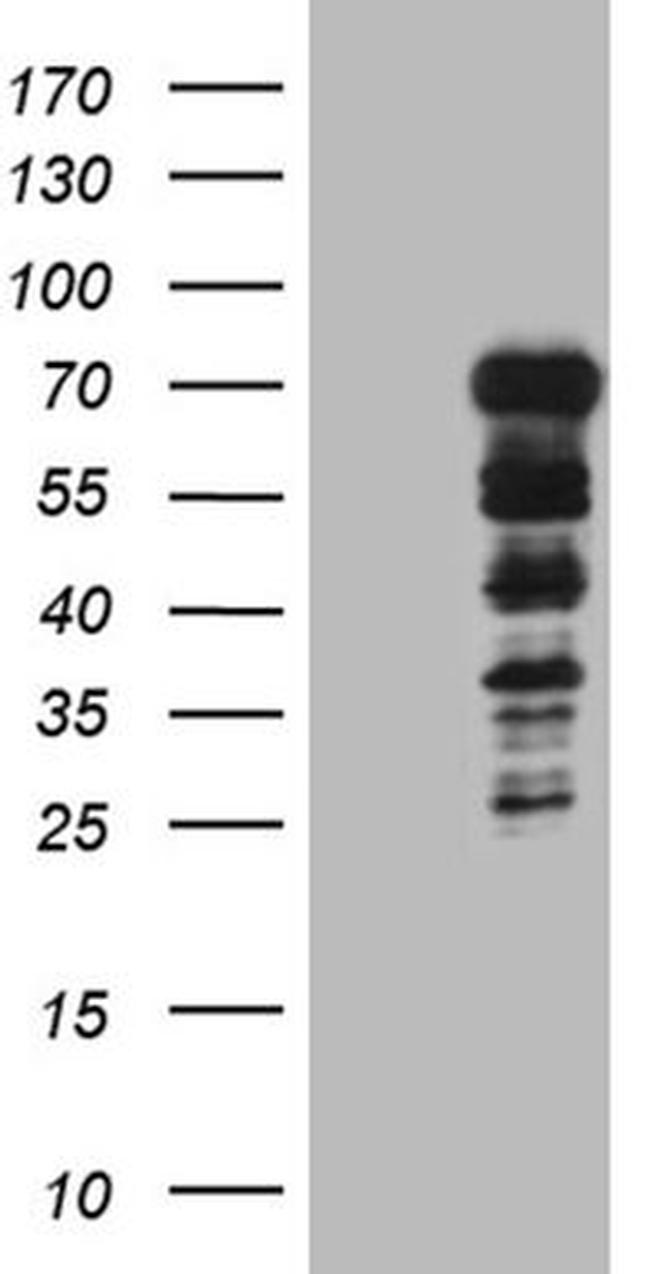 DCP1B Antibody in Western Blot (WB)