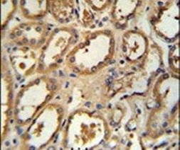 DCP2 Antibody in Immunohistochemistry (IHC)