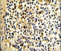 DCXR Antibody in Immunohistochemistry (IHC)