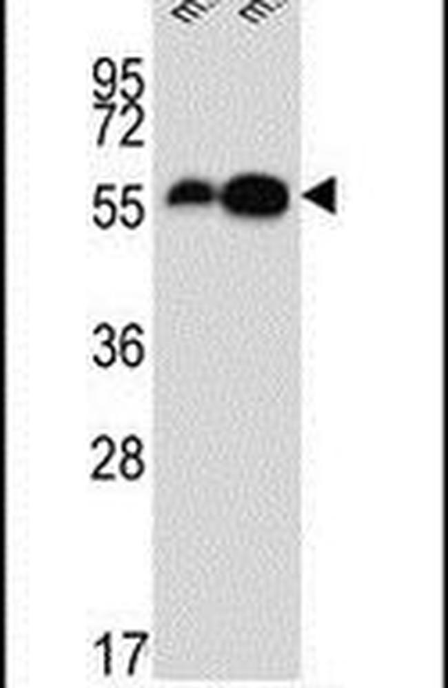 DOPA Decarboxylase Antibody in Western Blot (WB)