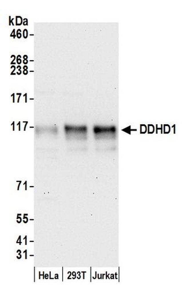 DDHD1 Antibody in Western Blot (WB)