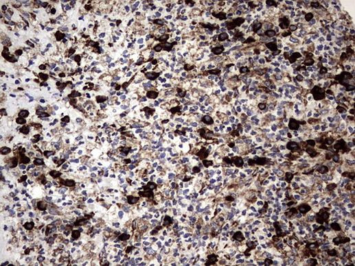 DDOST Antibody in Immunohistochemistry (Paraffin) (IHC (P))