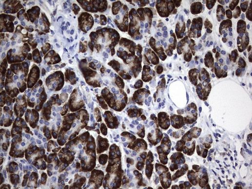 DDOST Antibody in Immunohistochemistry (Paraffin) (IHC (P))