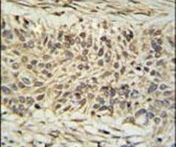 DDX23 Antibody in Immunohistochemistry (IHC)
