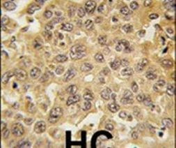 DDX3 Antibody in Immunohistochemistry (IHC)