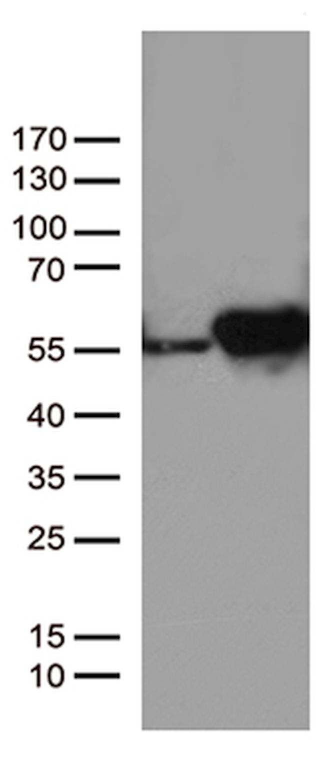 DDX39B Antibody in Western Blot (WB)
