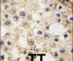 DDX4 Antibody in Immunohistochemistry (IHC)