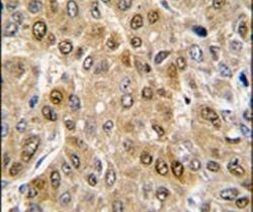 DDX5 Antibody in Immunohistochemistry (IHC)