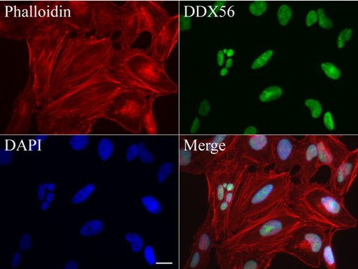 DDX56 Antibody in Immunocytochemistry (ICC/IF)