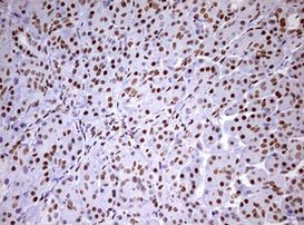 DDX56 Antibody in Immunohistochemistry (Paraffin) (IHC (P))