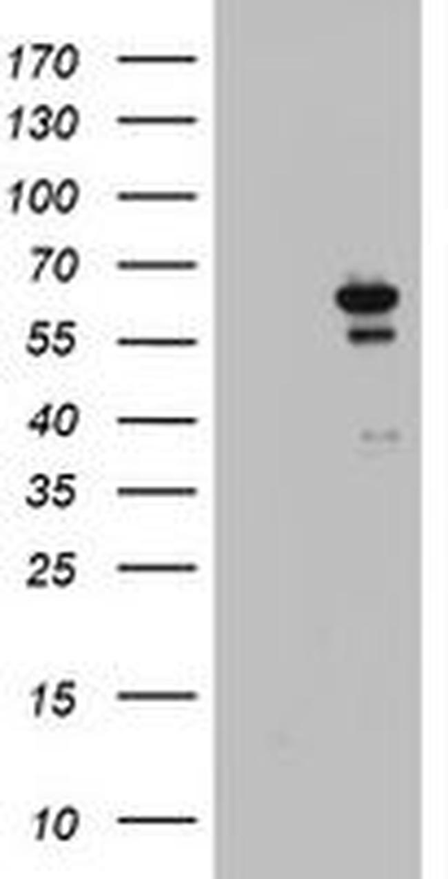 DDX56 Antibody in Western Blot (WB)