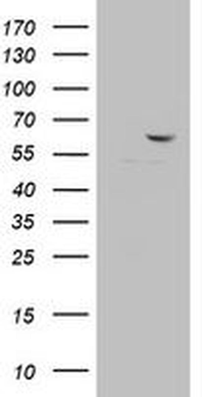 DDX56 Antibody in Western Blot (WB)