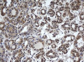 DDX59 Antibody in Immunohistochemistry (Paraffin) (IHC (P))