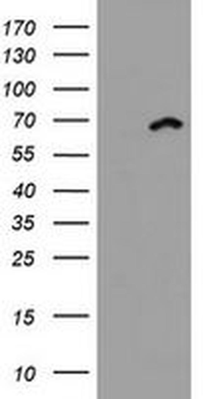 DDX59 Antibody in Western Blot (WB)