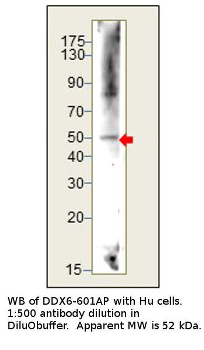 DDX6 Antibody in Western Blot (WB)